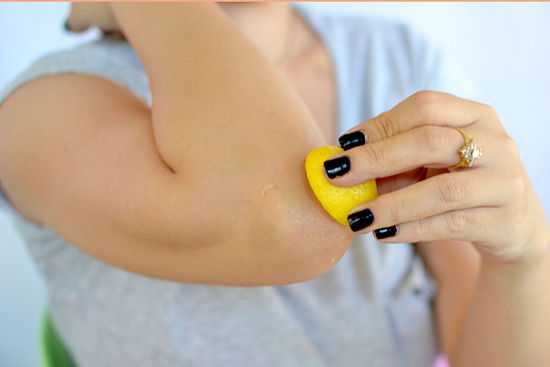 ginocchia e gomiti neri