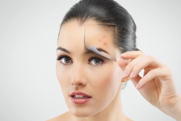 rimedi contro macchie della pelle