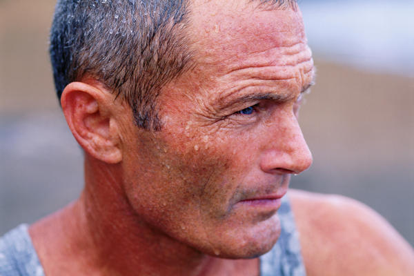 sudorazione eccessiva rimedi naturali