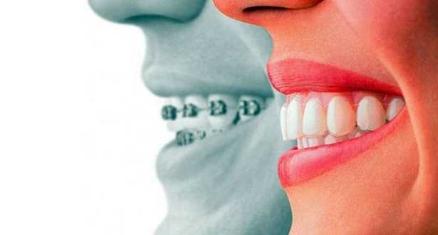 Apparecchio invisibile