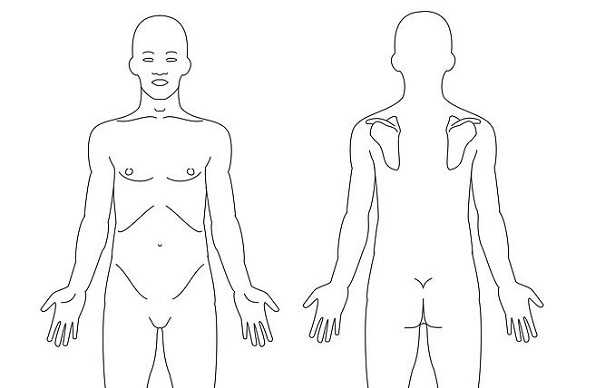 disestesia disestesia