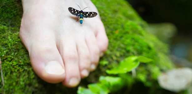 Alluce varo Alluce varo