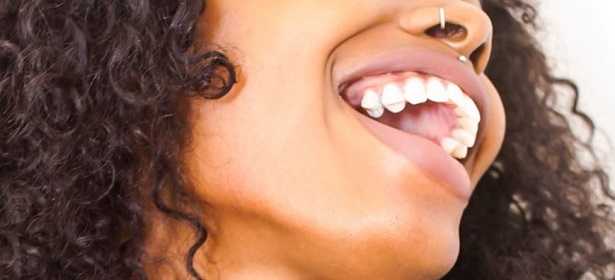 Corrosione galvanica