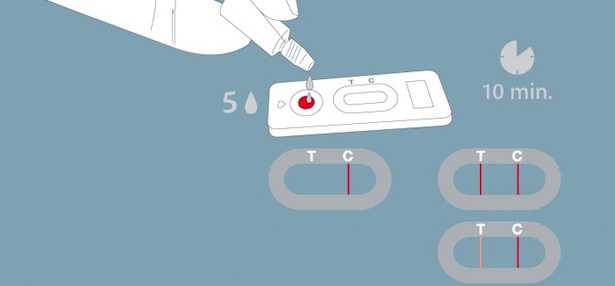 test allergie primaverili sintomi