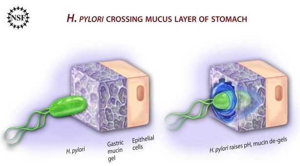 Helicobacter pylori Helicobacter pylori