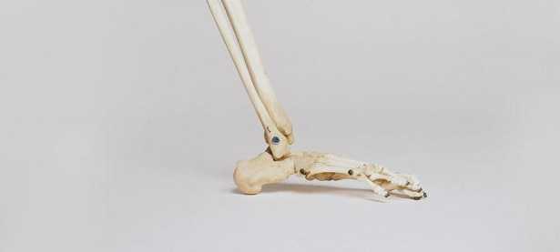 Densitometria ossea Densitometria ossea