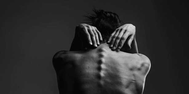 Densitometria ossea Densitometria ossea