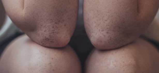 Pigmentazione cutanea