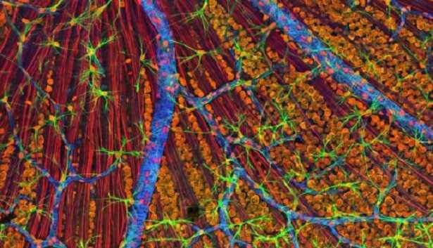 Microscopio elettronico