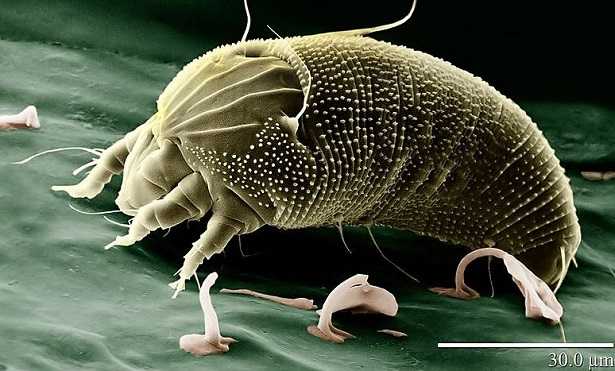 Microscopio elettronico