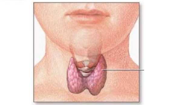 Tiroidite di Hashimoto