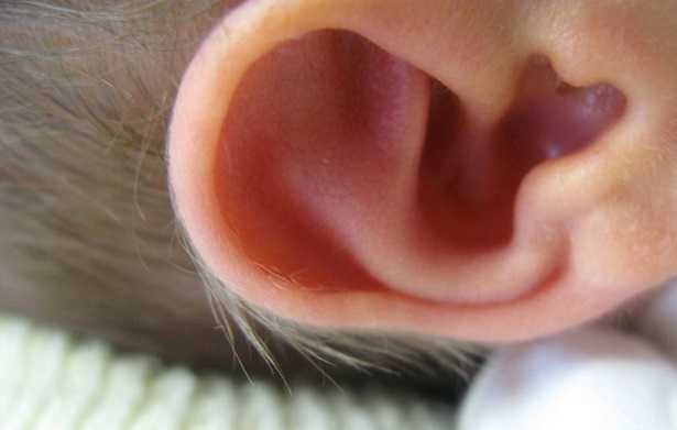 Udito ovattato Udito ovattato