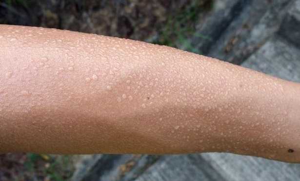 Perspirazione Perspirazione