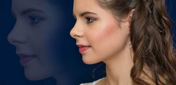 Piramide nasale: frattura