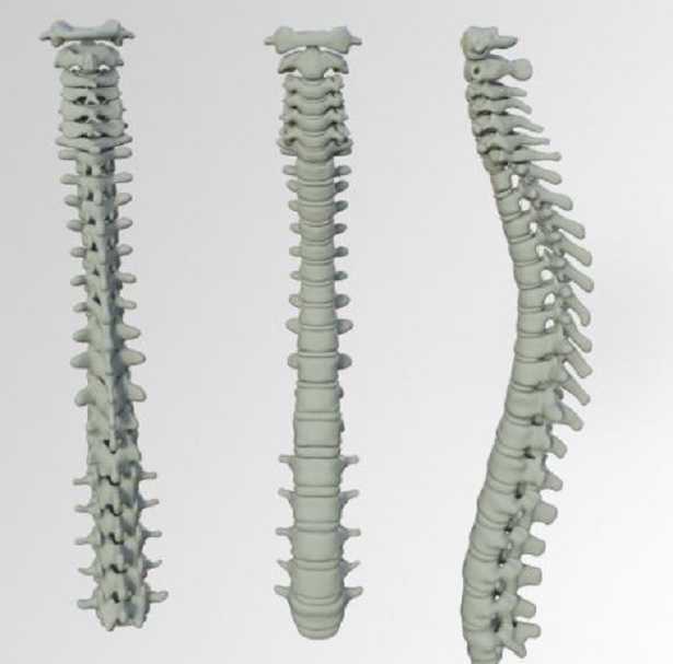 Paramorfismo: prevenzione