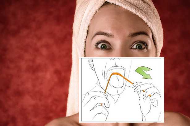 Patina batterica linguale