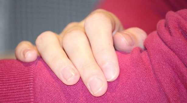 Come smettere di mangiarsi le unghie 