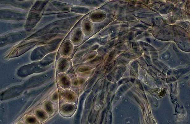 Microspora e protozoi