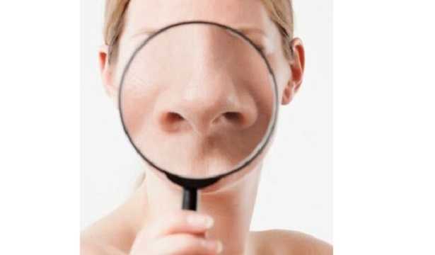 Rinoplastica chirurgica