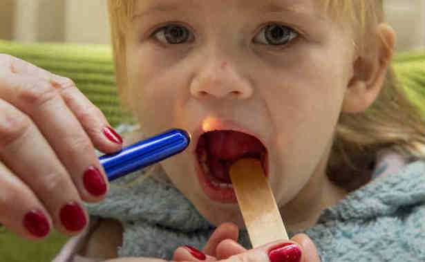 scarlattinetta bambini