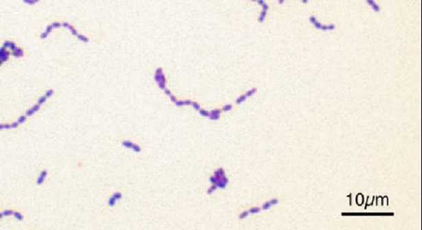 Streptococcus agalactiae Streptococcus agalactiae