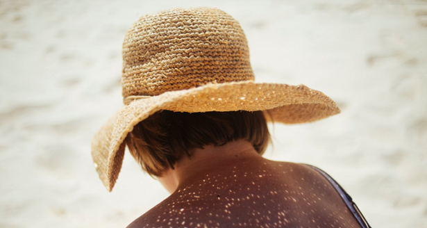 Sole sulle cicatrici