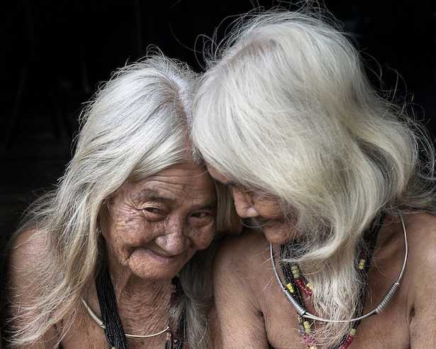 capelli bianchi cause