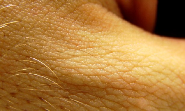 Malattie psicosomatiche della pelle