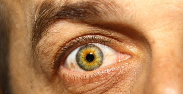 Occhio verde Occhio verde