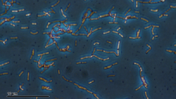 Come si cura la disbiosi Come si cura la disbiosi
