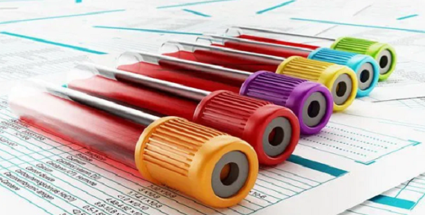 Cosa sono i test sierologici per il coronavirus