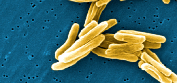 batteri alimenti batteri alimenti